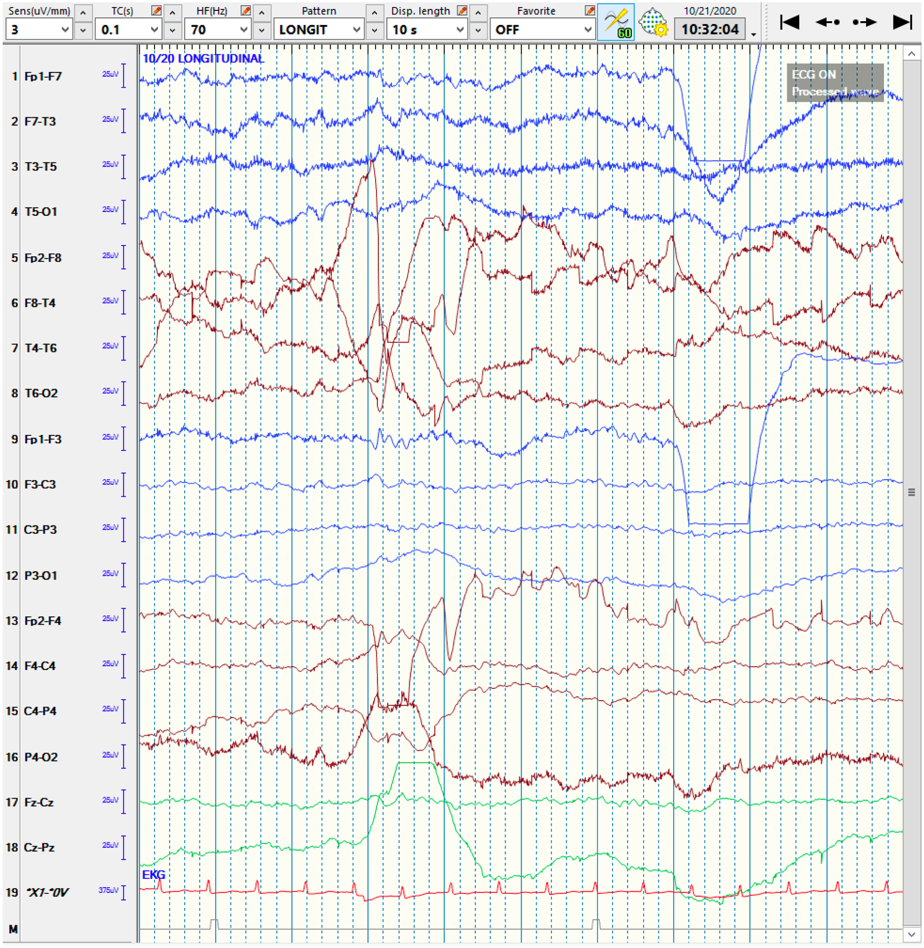 Figure 3: