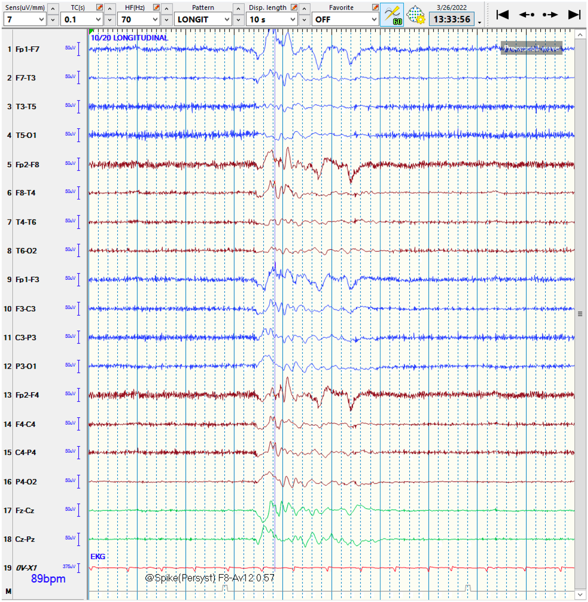 Figure 2: