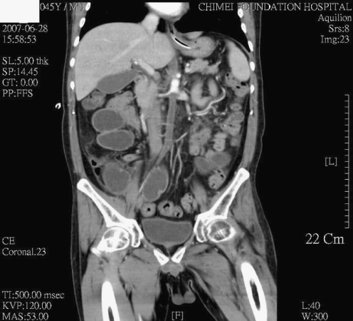Fig. 1