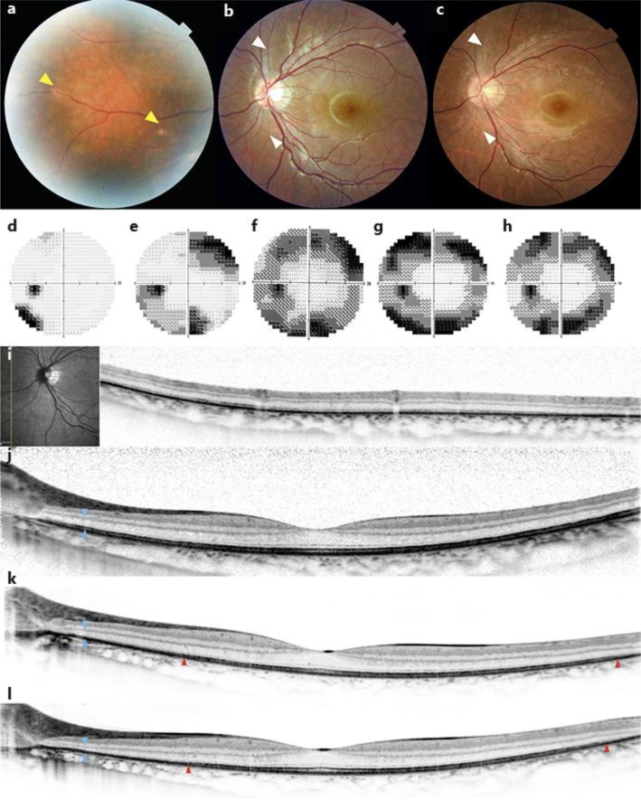 Fig. 1