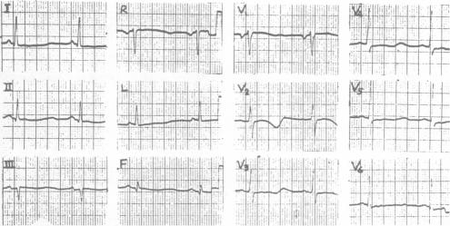 graphic file with name westjmed00202-0044-a.jpg