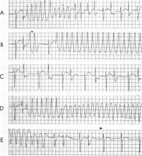 graphic file with name westjmed00202-0043-a.jpg