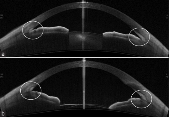 Figure 22