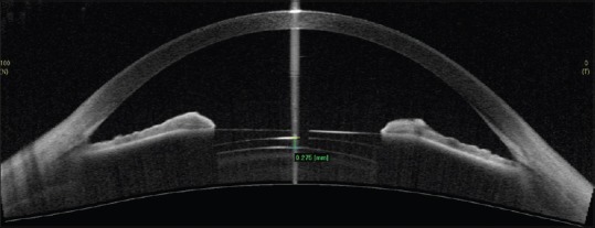 Figure 20