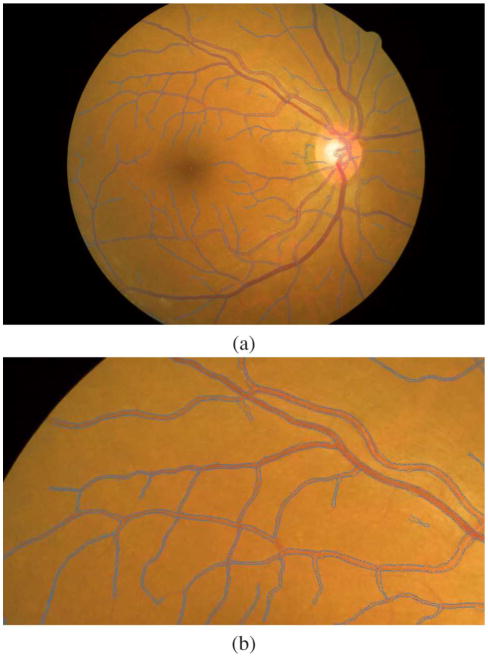 Fig. 4