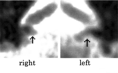 Fig. 5