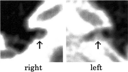 Fig. 6