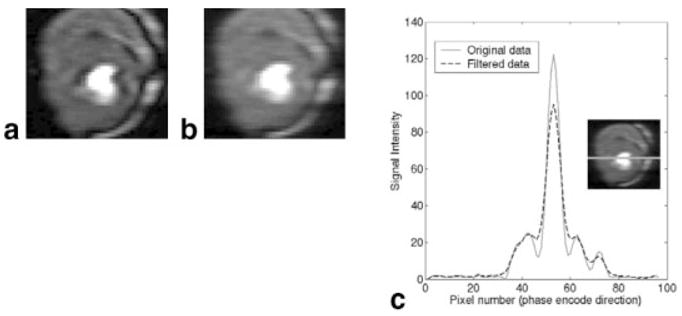 FIG. 6