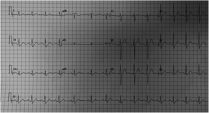 FIGURE 1