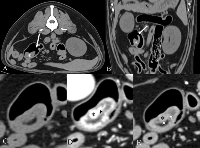 Fig. 2.