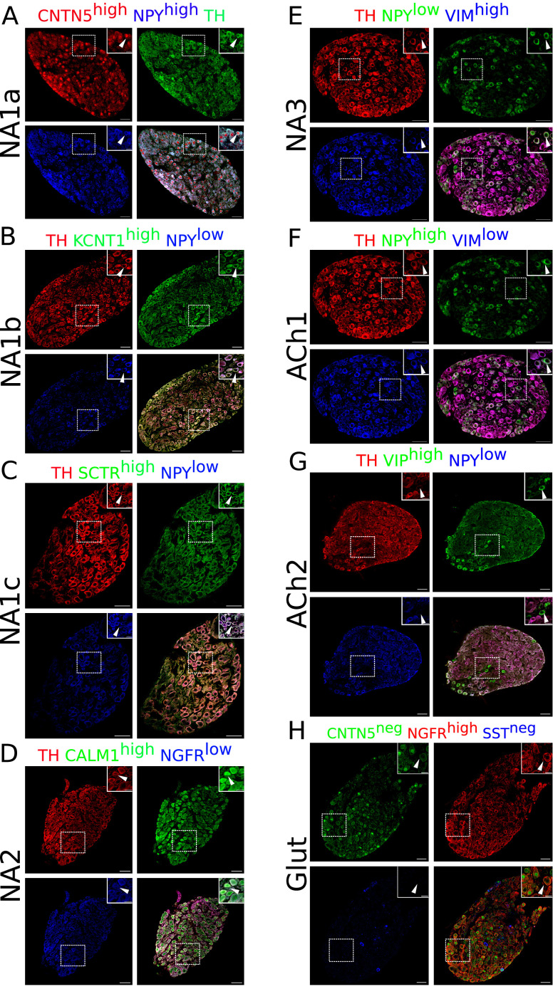 Figure 1—figure supplement 6.