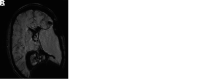 FIG 4.