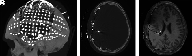 FIG 2.