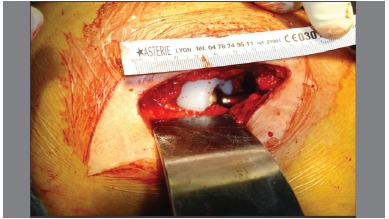 Figure1. Posterior