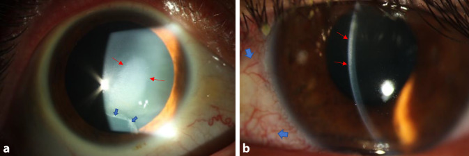 graphic file with name 347_2020_1241_Fig1_HTML.jpg