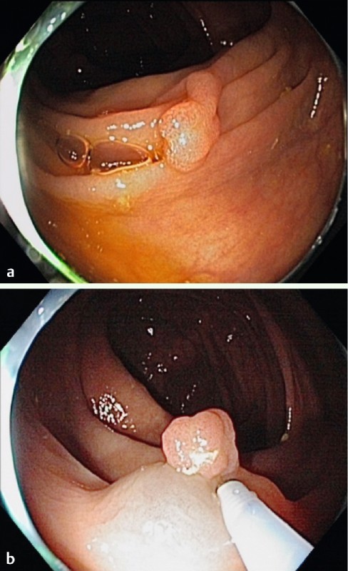 Fig. 2 a 