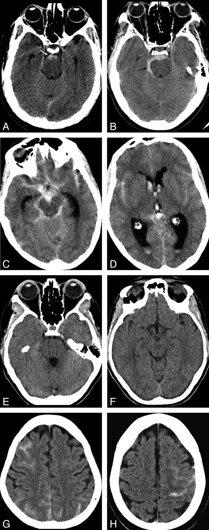 Fig 1.