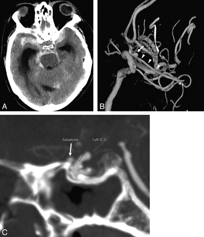 Fig 3.