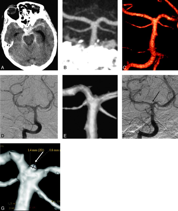 Fig 4.