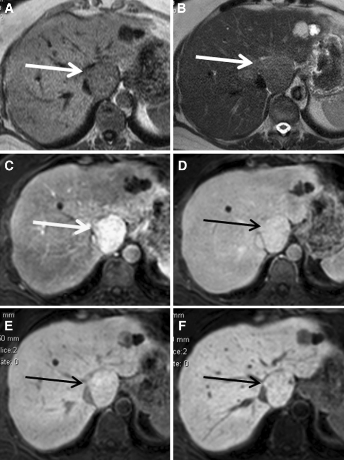 Fig. 5