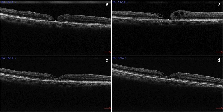 Fig. 2