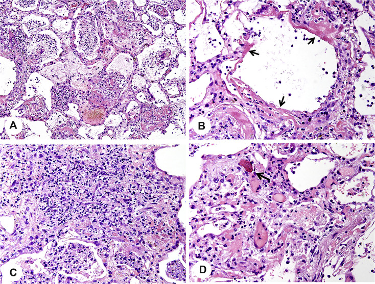 Fig. 3