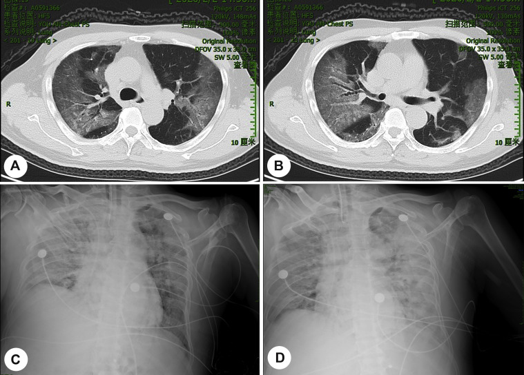 Fig. 1