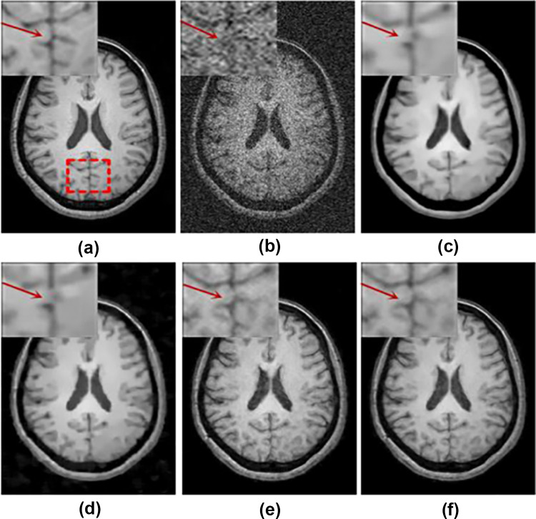 Fig. 5