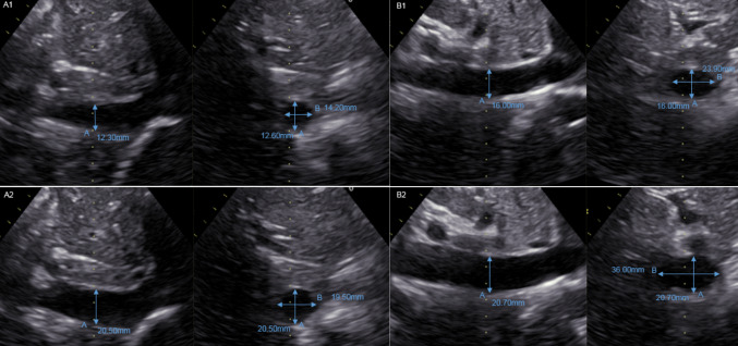 Fig. 6