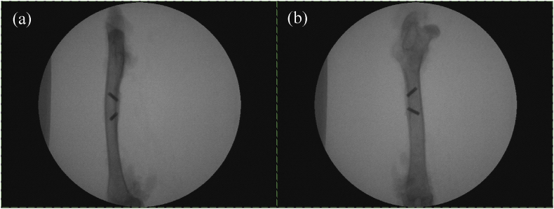 Fig. 4