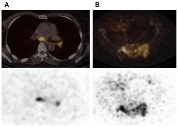 Fig. 16