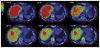 Fig. 12