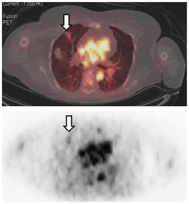 Fig. 10