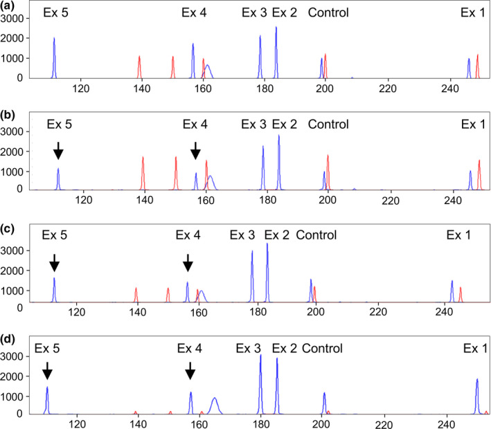 FIGURE 2