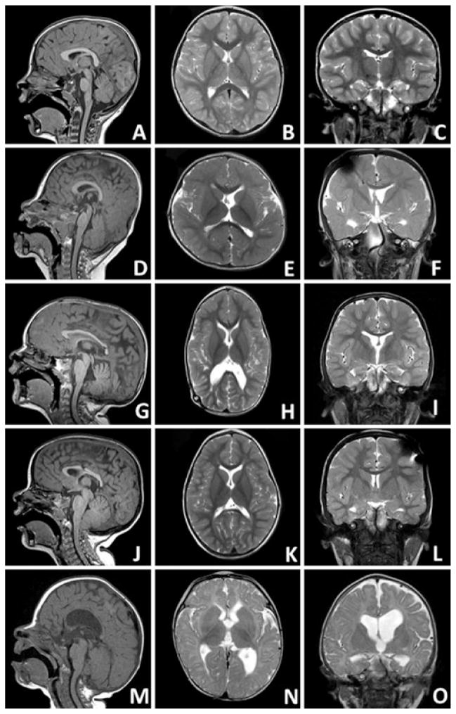 FIG 4