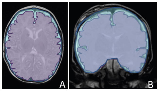 FIG 1