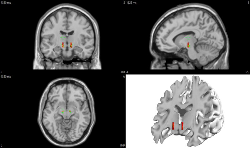 Figure 14