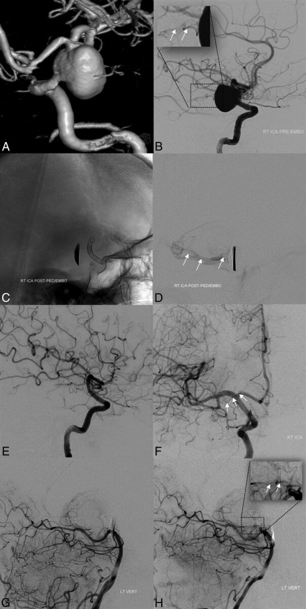 Fig 3.