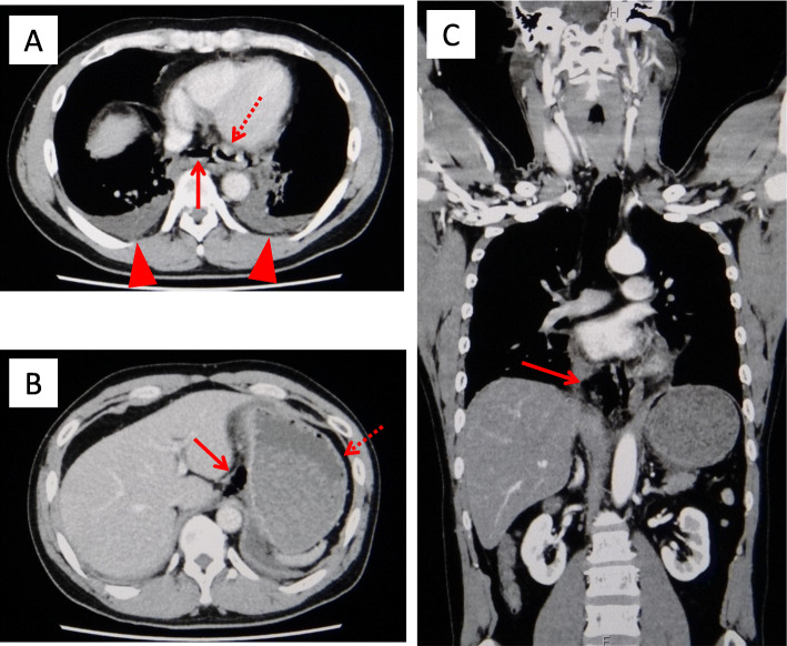 Fig. 2