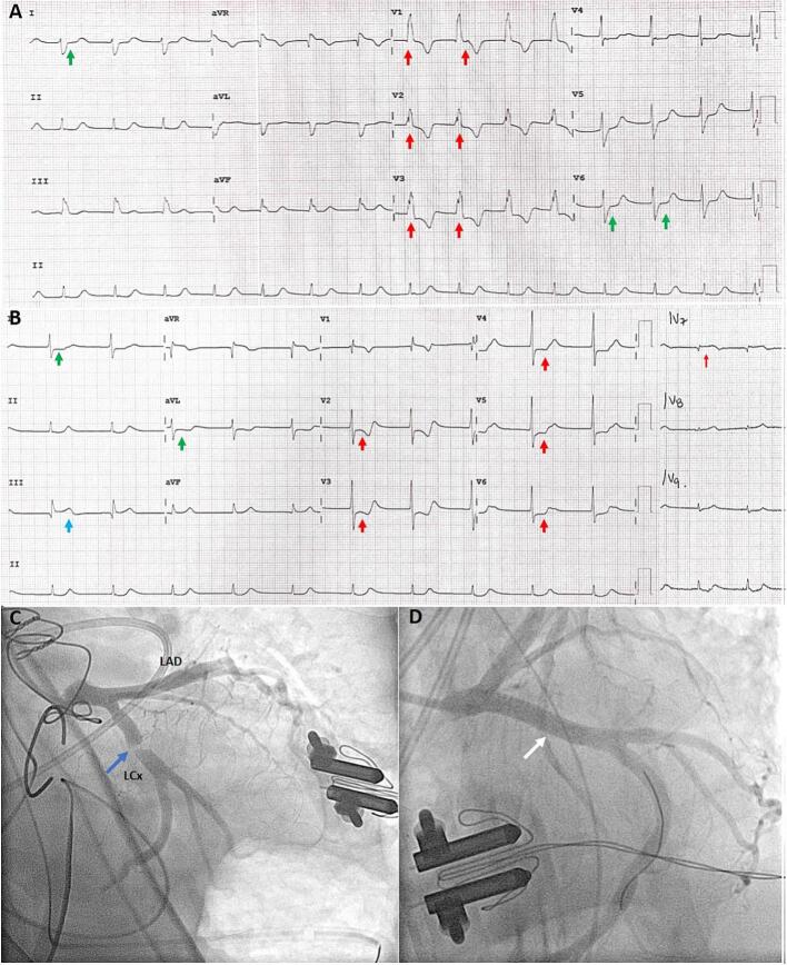 Fig. 2