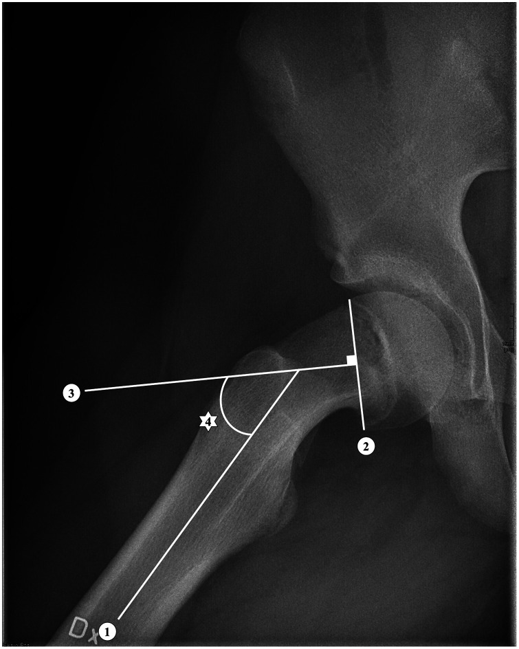 Comparison of different radiographic methods to measure the slip angle ...