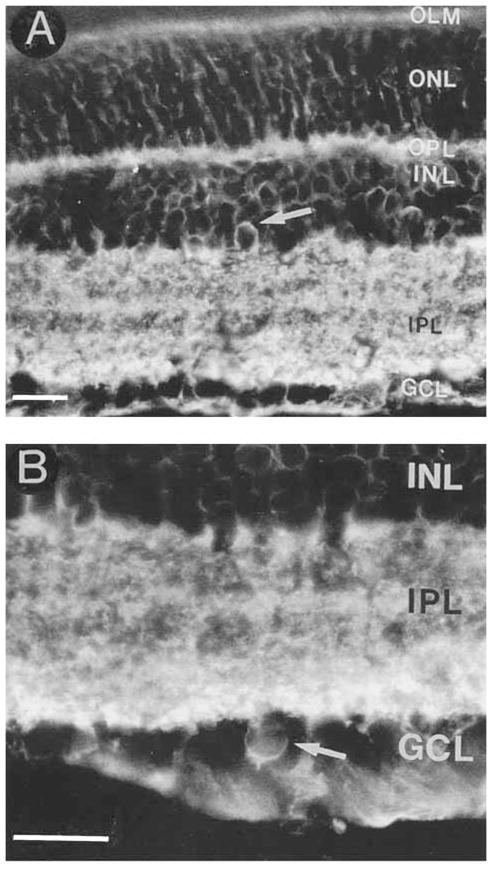 Fig. 11