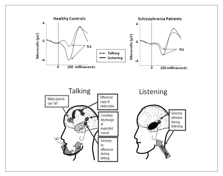 Figure 1 Schema of Talk/Listen Paradigm and resulting event related
potentials from healthy controls and patients with schizophrenia