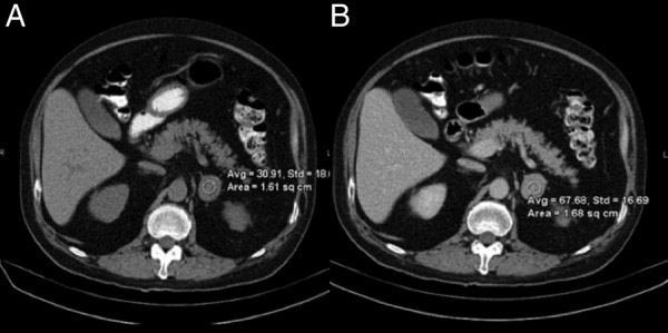 Figure 2