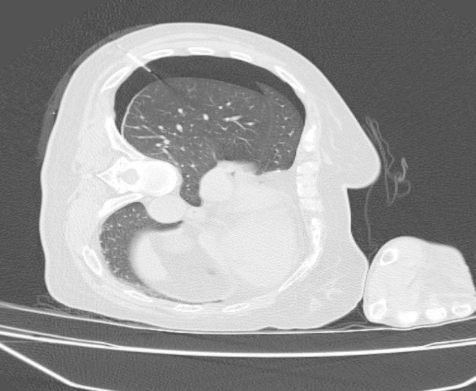 Fig. 5