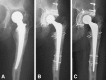 Fig. 2A–C