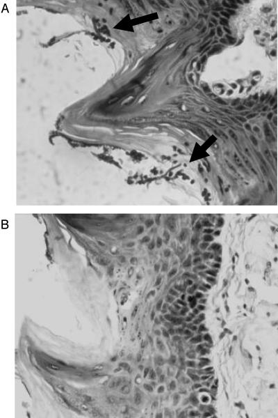 FIG. 5.