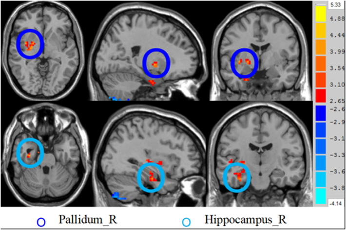 Fig. 2