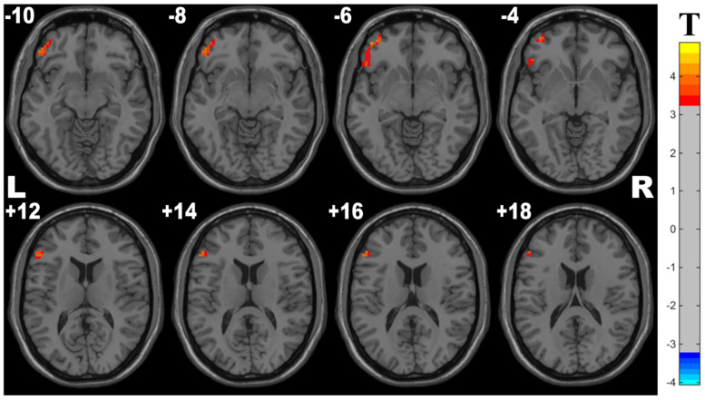 FIGURE 3