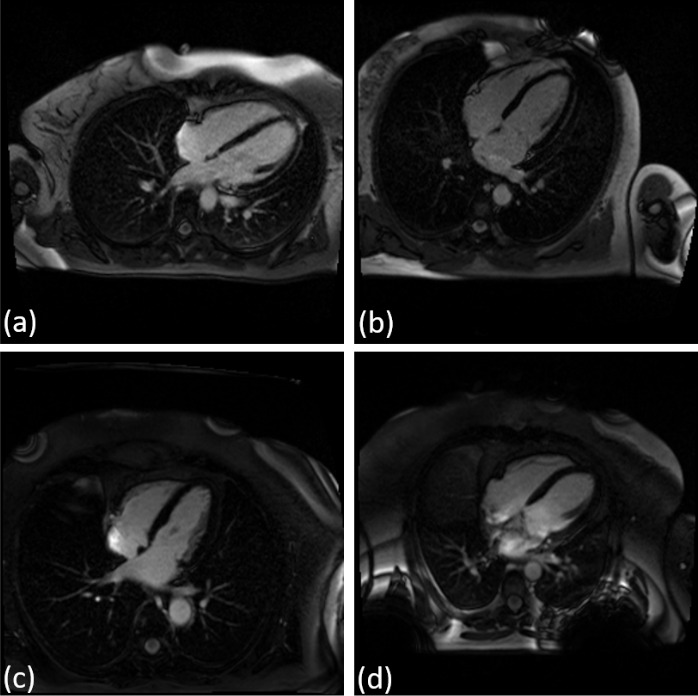 Fig. 10